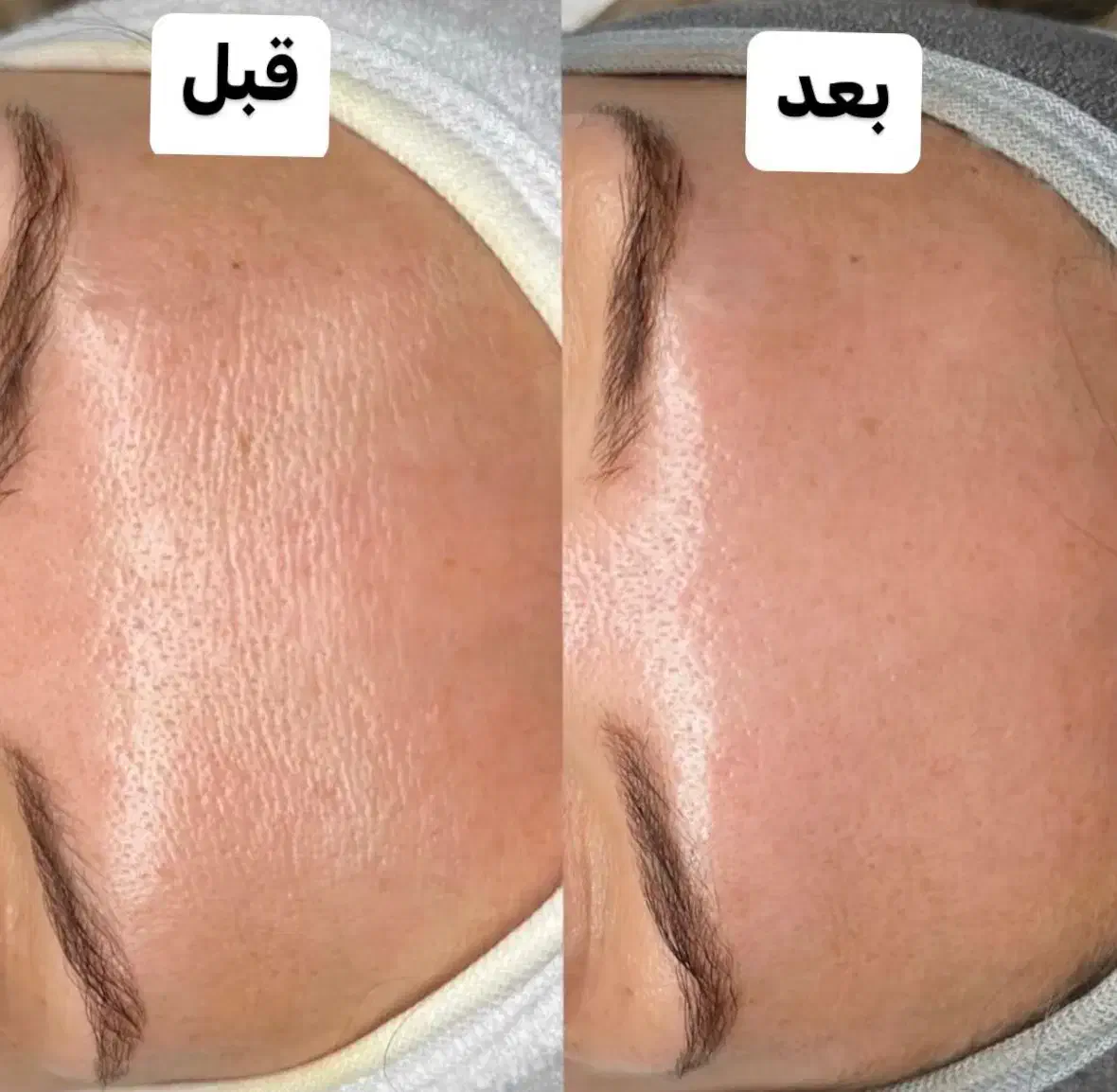 پوست سالم میخوای من کمکت میکنم فیشال بانوان|خدمات آرایشگری و زیبایی|شیراز, بعثت|دیوار