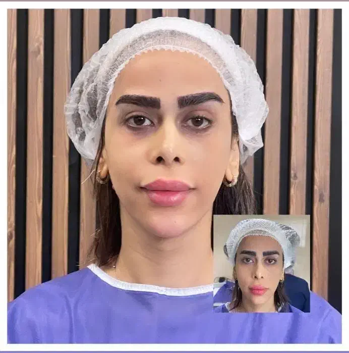 مدل کاشت ابرو فقطو فقط هفت تومن|خدمات آرایشگری و زیبایی|تهران, شهرک پرواز|دیوار