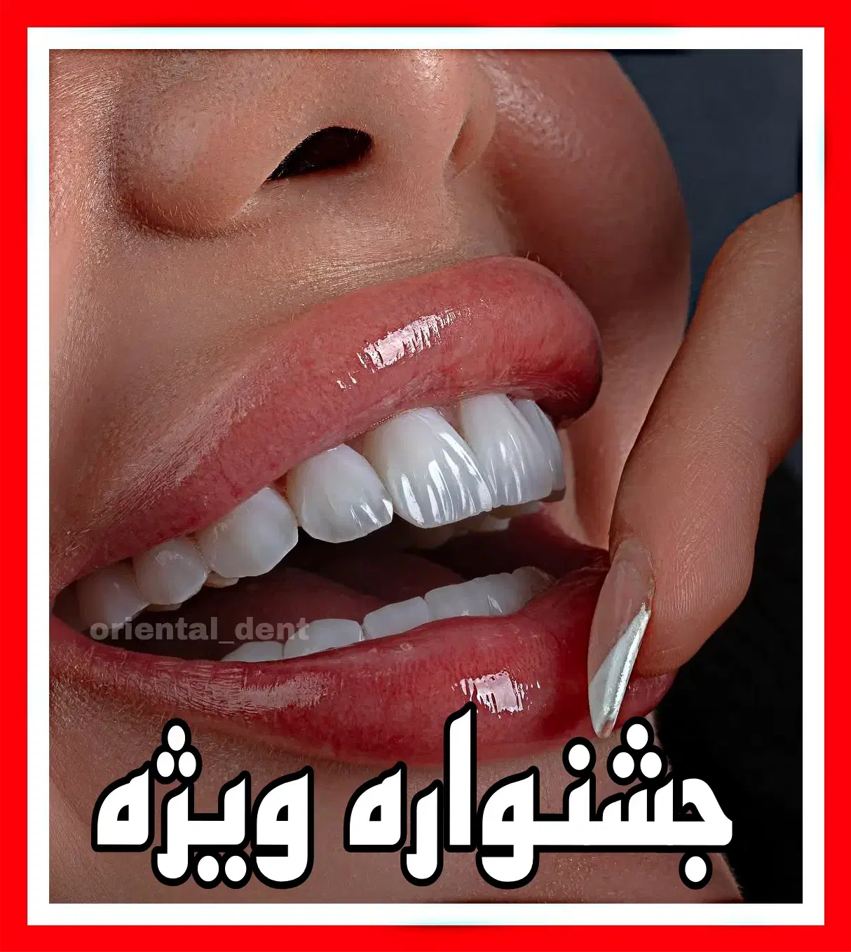 کامپوزیت دندان/ترمیم/دندانپزشکی/عصبکشی|خدمات آرایشگری و زیبایی|تهران, تهرانپارس شرقی|دیوار