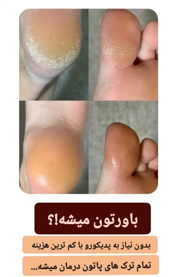 زیبایی از آریا شروع میشه حس رضایتی که از اول|آرایشی، بهداشتی، درمانی|اراک, |دیوار