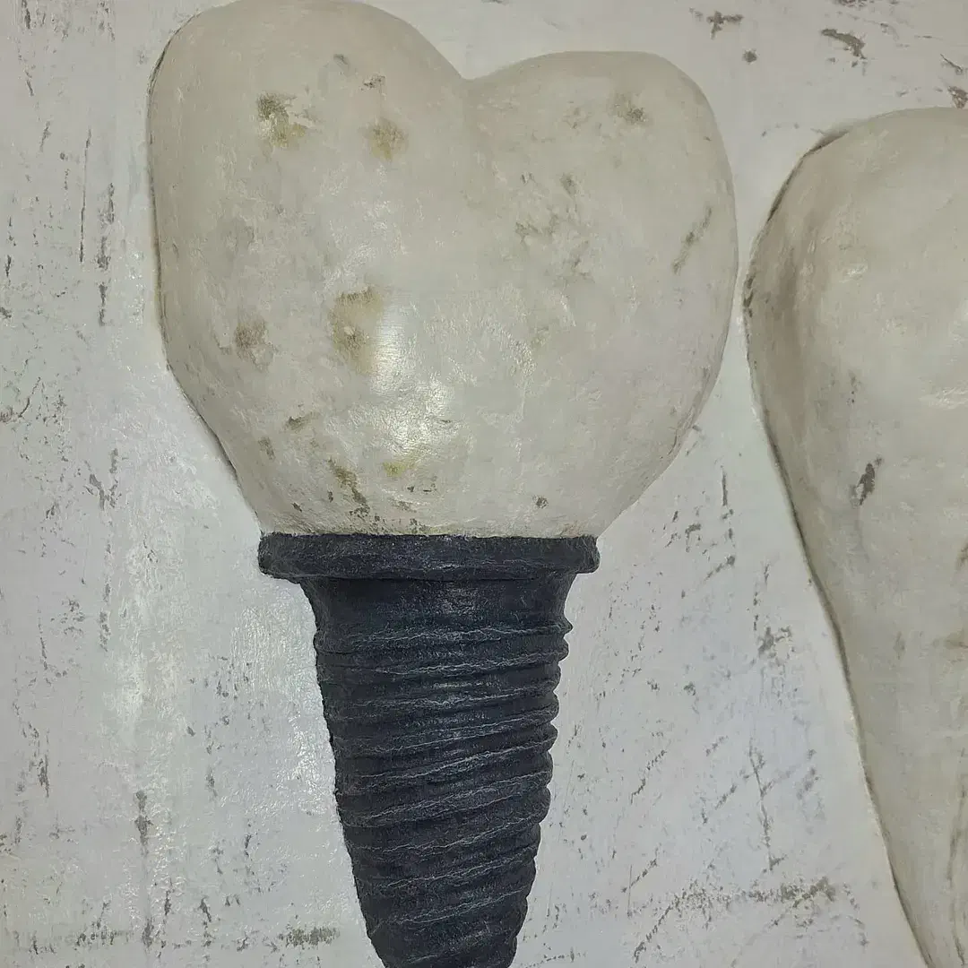 پاپیه ماشه دندان ایمپلنت|مجسمه، تندیس، ماکت|ارومیه, |دیوار