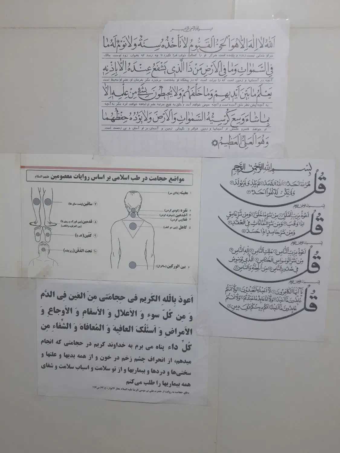 حجامت فصد طب سوزنی کایروپراکتیک بادکش رگ گیری|خدمات آرایشگری و زیبایی|نسیم‌شهر, |دیوار