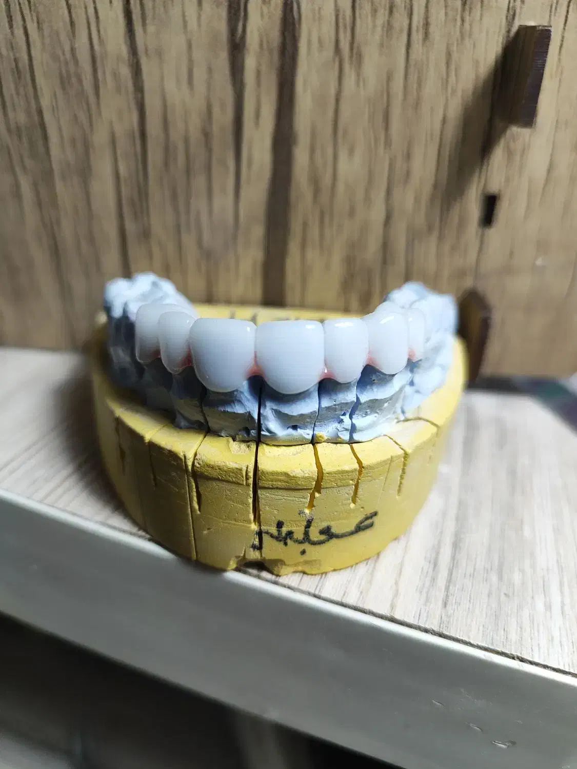 لابراتوار دندانسازی (روکش ثابت)|پزشکی|کرمانشاه, |دیوار