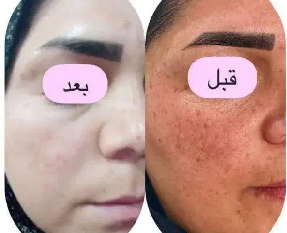 کرم گیاهی|آرایشی، بهداشتی، درمانی|بهار, |دیوار