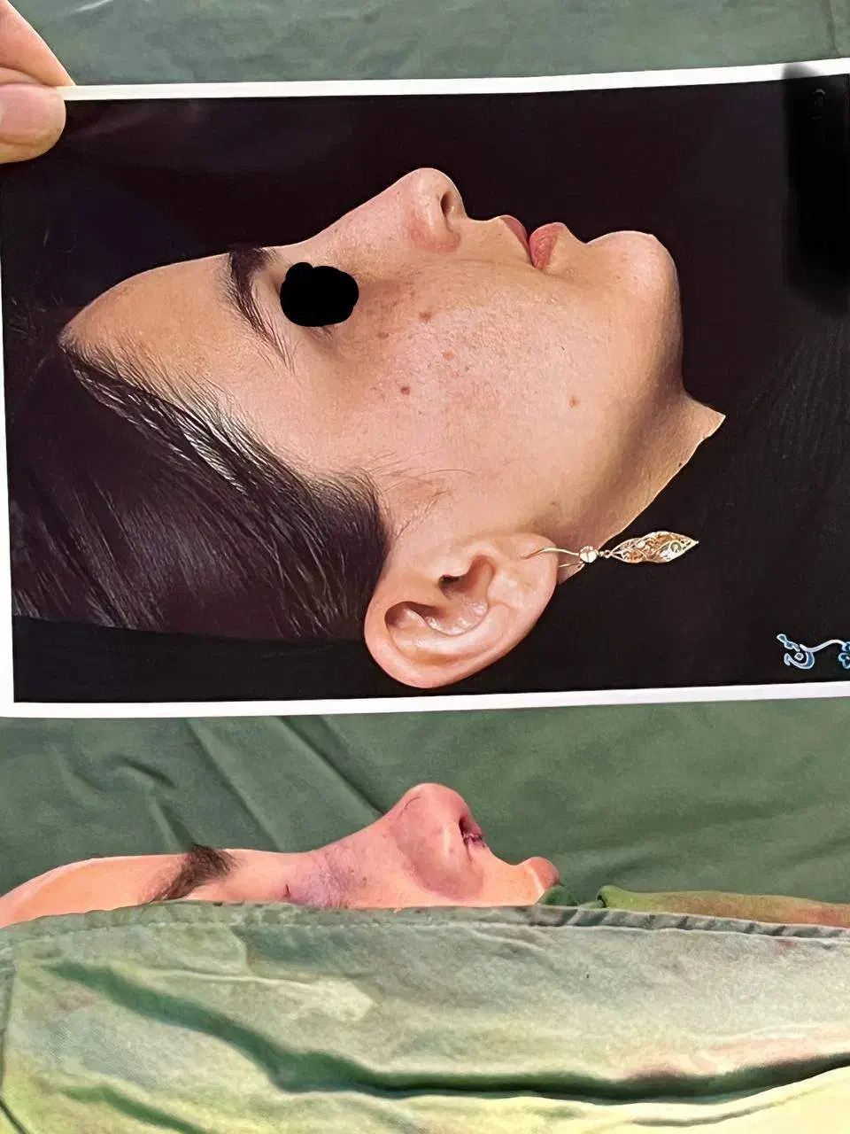 جشنواره بینظیر واستثنایی جراحی زیبایی بینی و صورت|خدمات آرایشگری و زیبایی|اردبیل, |دیوار