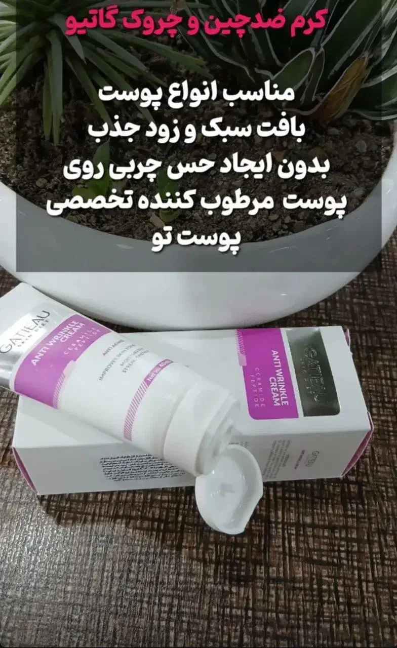 کرم بوتاکس|آرایشی، بهداشتی، درمانی|صفادشت, |دیوار