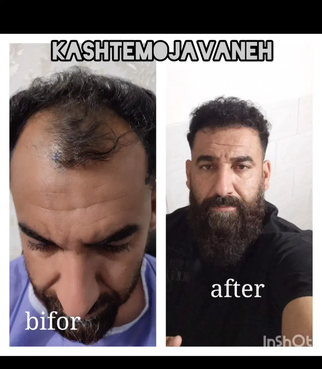 جشنواره یلدایی کاشت موشیرازی از۱۳تومن|خدمات آرایشگری و زیبایی|تهران, صد دستگاه|دیوار