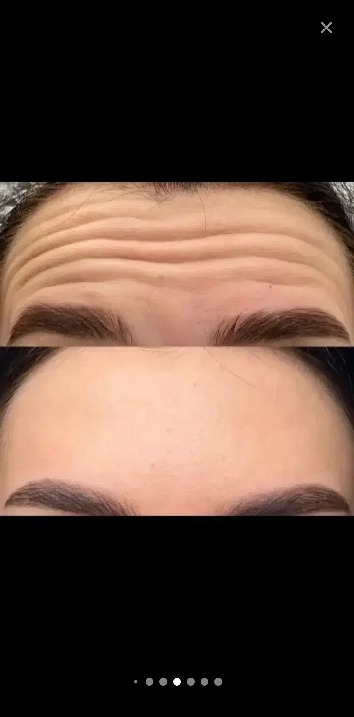 پرسینگ همه بدن 180|بدلیجات|اهواز, حصیرآباد|دیوار