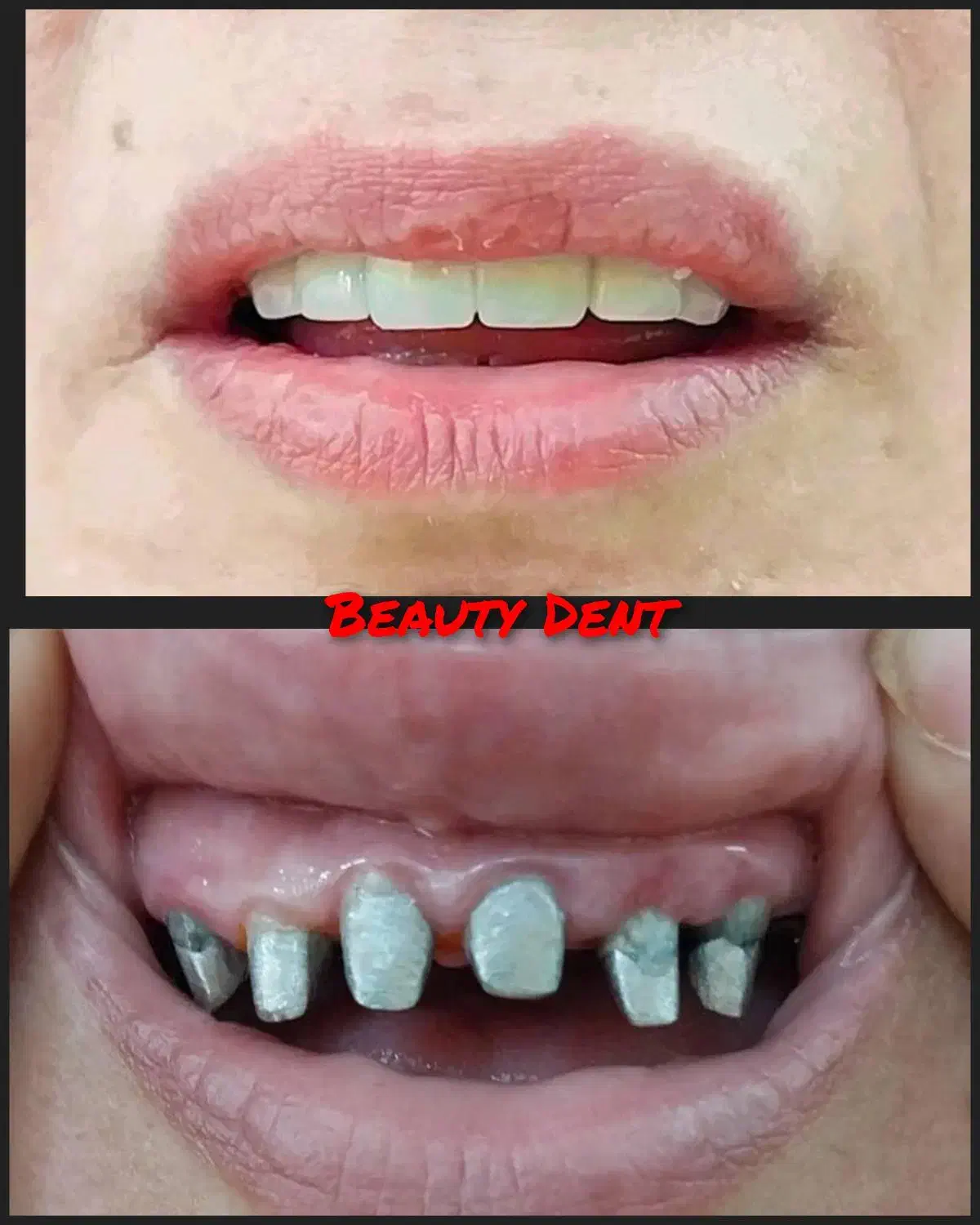 دندانسازی دندان سازی|پزشکی|مشهد, سرافرازان|دیوار