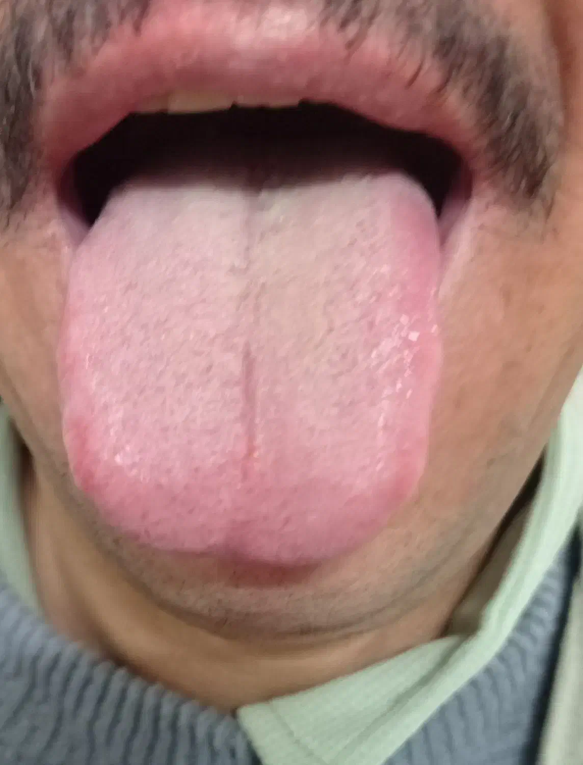 بیماری|خدمات آرایشگری و زیبایی|شیروان (خراسان), |دیوار