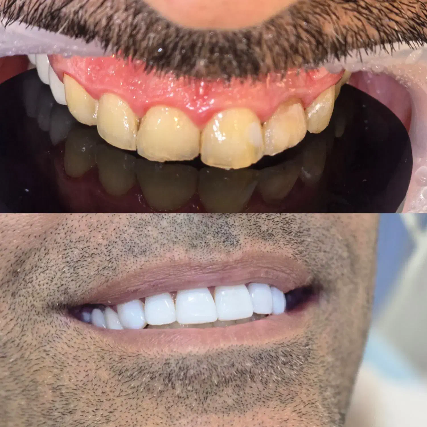 جشنواره دندانپزشکی اقساطی بدون پیش پرداخت|خدمات آرایشگری و زیبایی|شیراز, ستارخان|دیوار