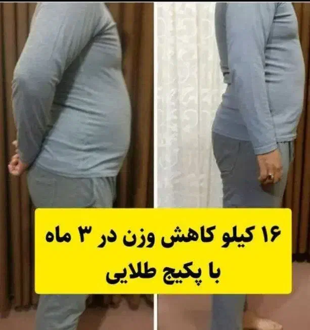 مینی پک چربی سوزی|فعالیت داوطلبانه|کرمانشاه, |دیوار