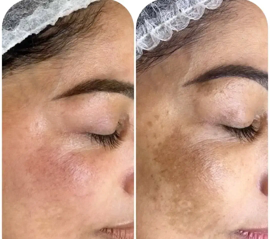 جذب نیروی خانم آنلاین باگوشی|استخدام بازاریابی و فروش|کازرون, |دیوار