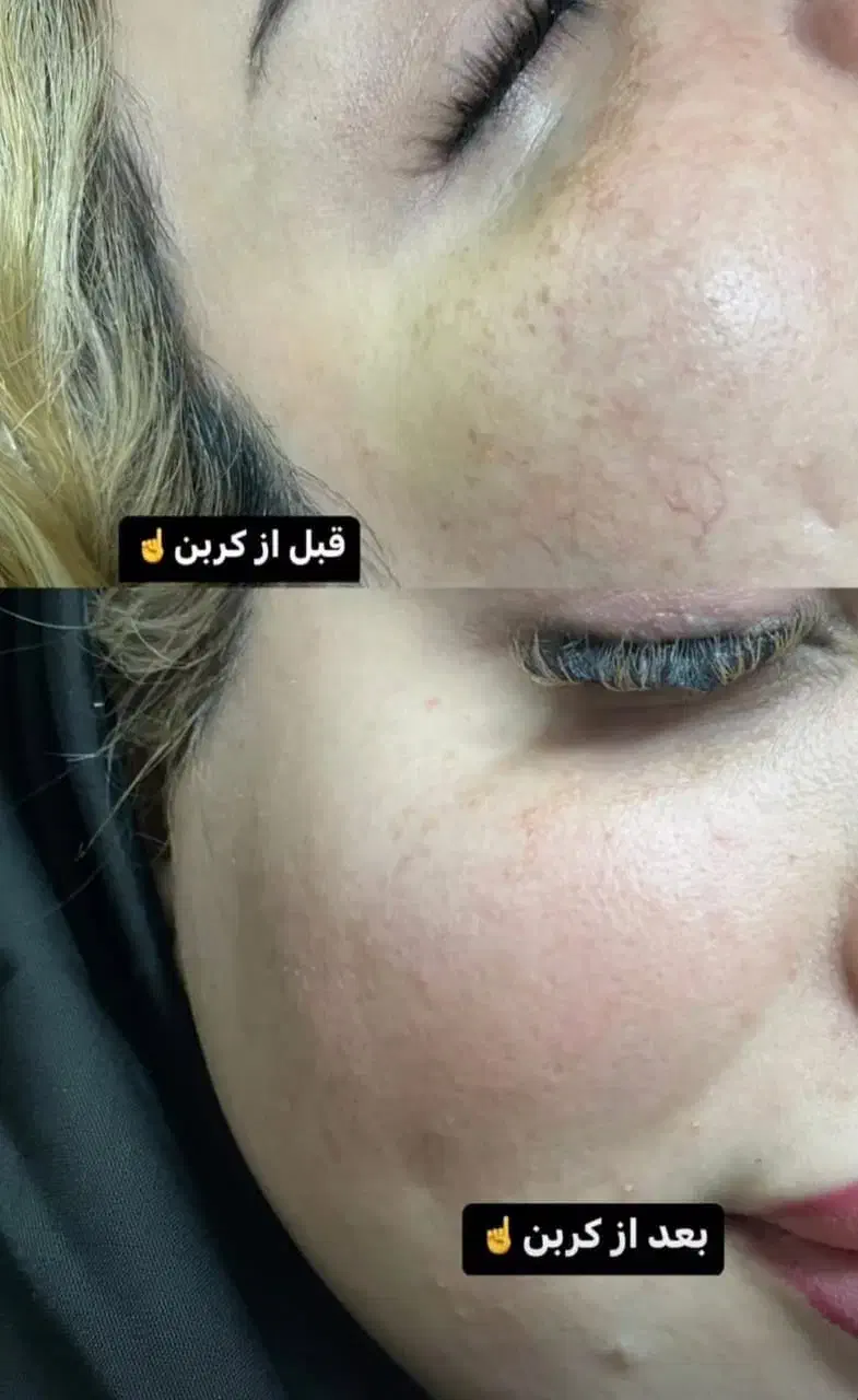 خدمات کلینیک سلامت سپید|خدمات آرایشگری و زیبایی|فولادشهر, A4|دیوار