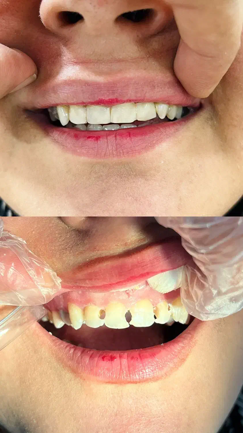 دندانپزشکی با پرداخت یک سوم هزینه|خدمات آرایشگری و زیبایی|سقز, |دیوار