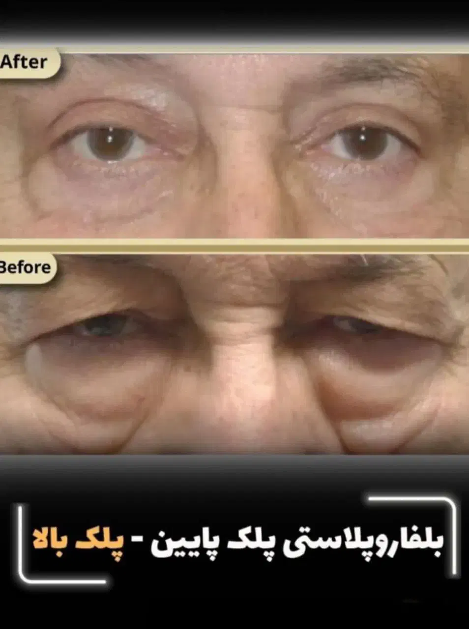 کاشت مو و ابرو/بوتاکس/بلفاروپلاستی/رفع غبغب/اقساطی|خدمات آرایشگری و زیبایی|تهران, سعادت‌آباد|دیوار