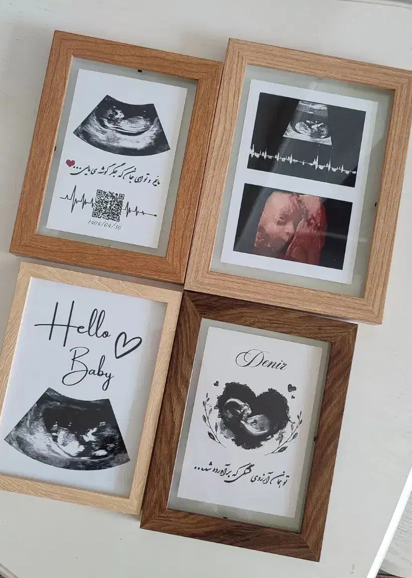 قاب عکس سونوگرافی|تابلو، نقاشی، عکس|مشهد, ایثارگران|دیوار