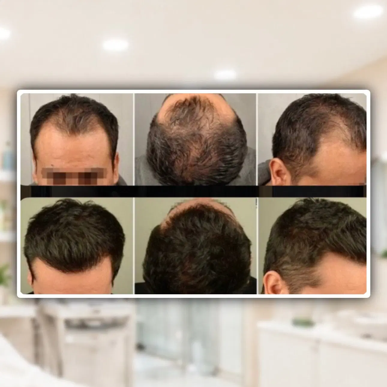 کچل نمیری..|آرایشی، بهداشتی، درمانی|تهران, نجات اللهی|دیوار