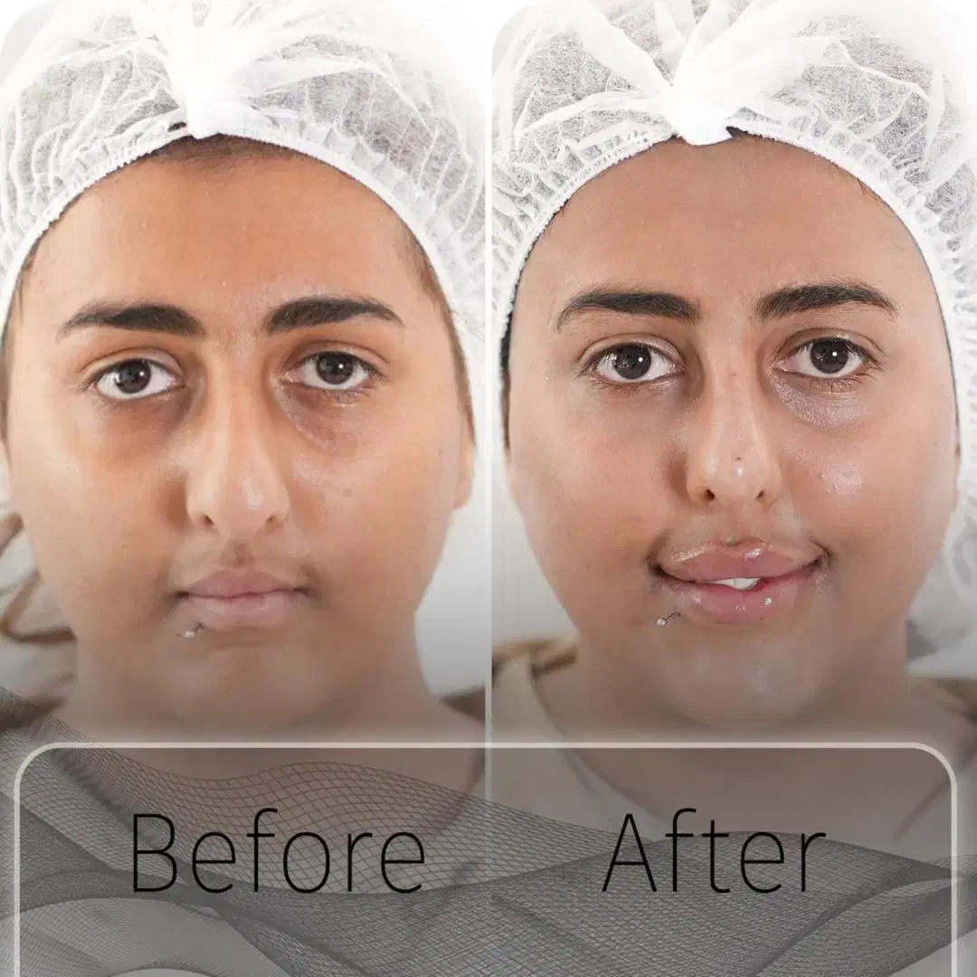 جوانسازی و لیفت بدون جراحی|خدمات آرایشگری و زیبایی|تهران, اختیاریه|دیوار