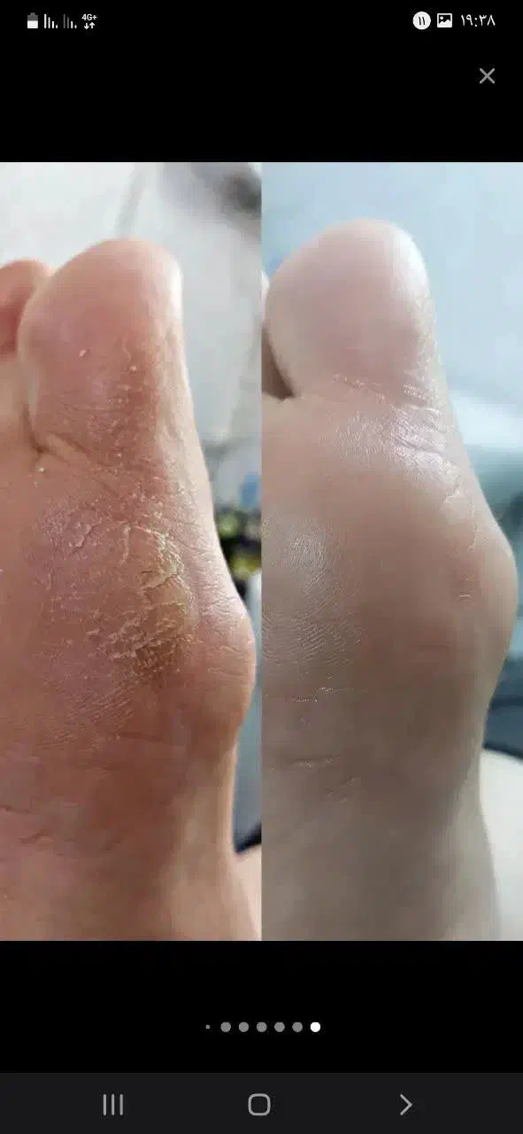 پدبکوروکفسابی|خدمات آرایشگری و زیبایی|قم, فرهنگیان و شهربانی|دیوار