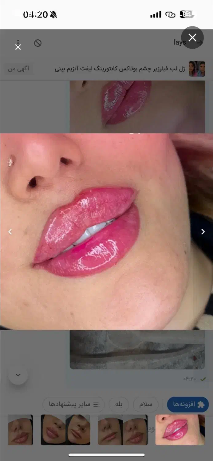 کلینیک پوست زیبایی تزریق ژل390مزوprp لیزر لاغری|خدمات آرایشگری و زیبایی|تهران, ستارخان|دیوار