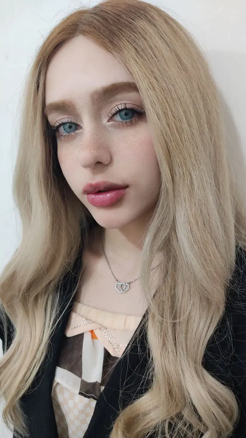 تزریقات تخصصی فیلر و بوتاکس|خدمات آرایشگری و زیبایی|مسجد سلیمان, |دیوار