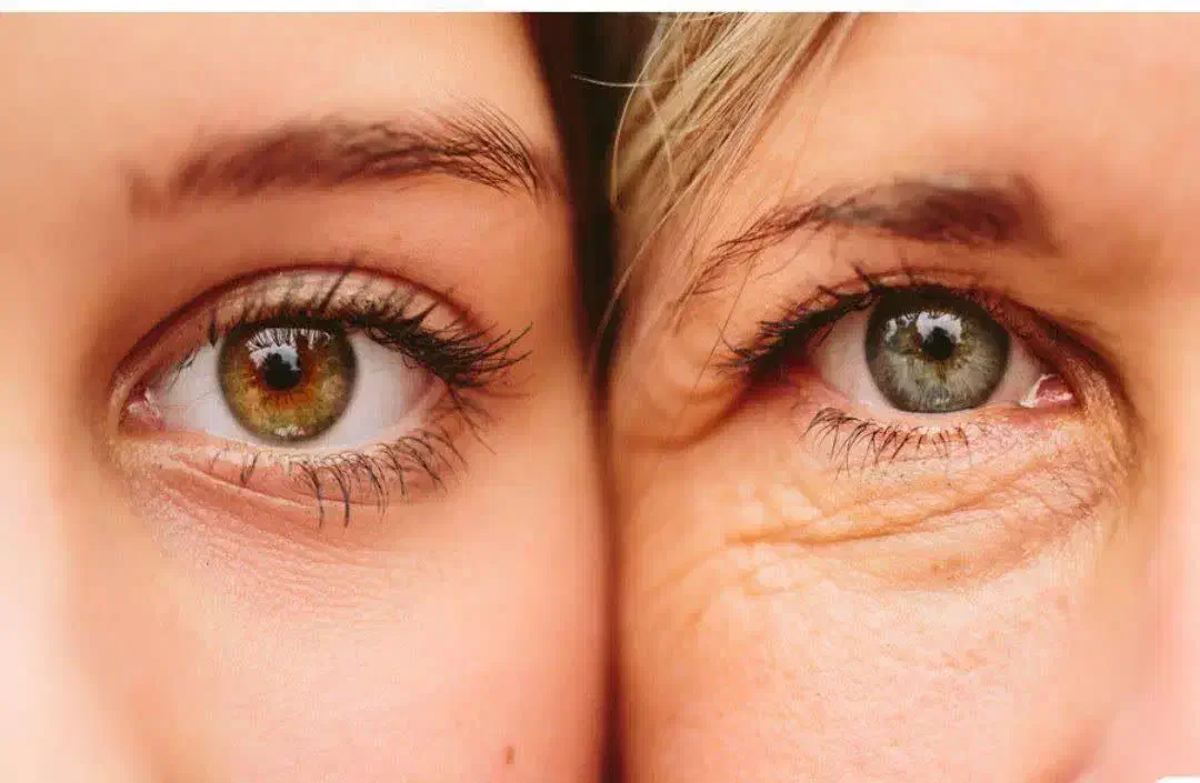 مشاوره پوست ومو|آرایشی، بهداشتی، درمانی|خورموج, |دیوار