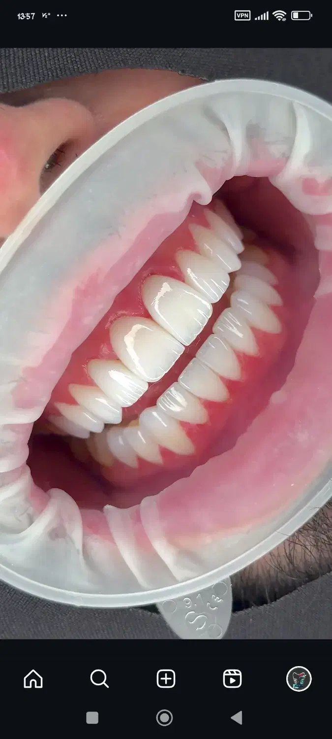 جشنواره ویژه دندان مصنوعی و...فقط 15 تومن|خدمات آرایشگری و زیبایی|فردیس, داوری|دیوار