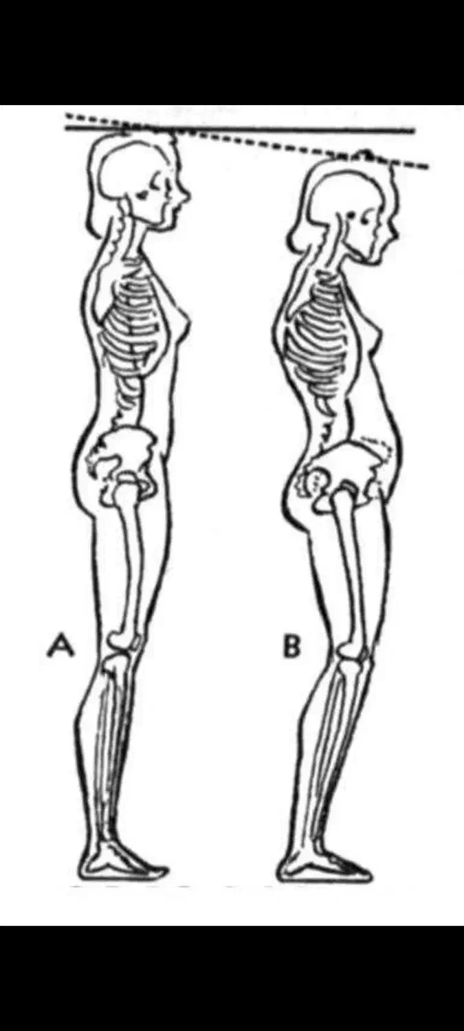 بدنِ خسته‌ت نیاز به توجه داره (کلاس اصلاحی بانوان)|خدمات آموزشی|گرگان, |دیوار