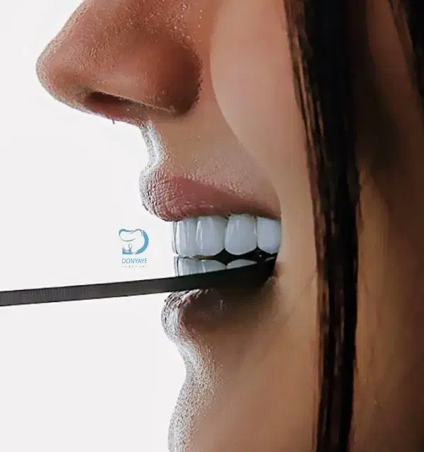 اقساط زیبایی ایمپلنت لمینیت کامپوزیت سجاد بهارستان|خدمات آرایشگری و زیبایی|مشهد, سجاد شهر|دیوار