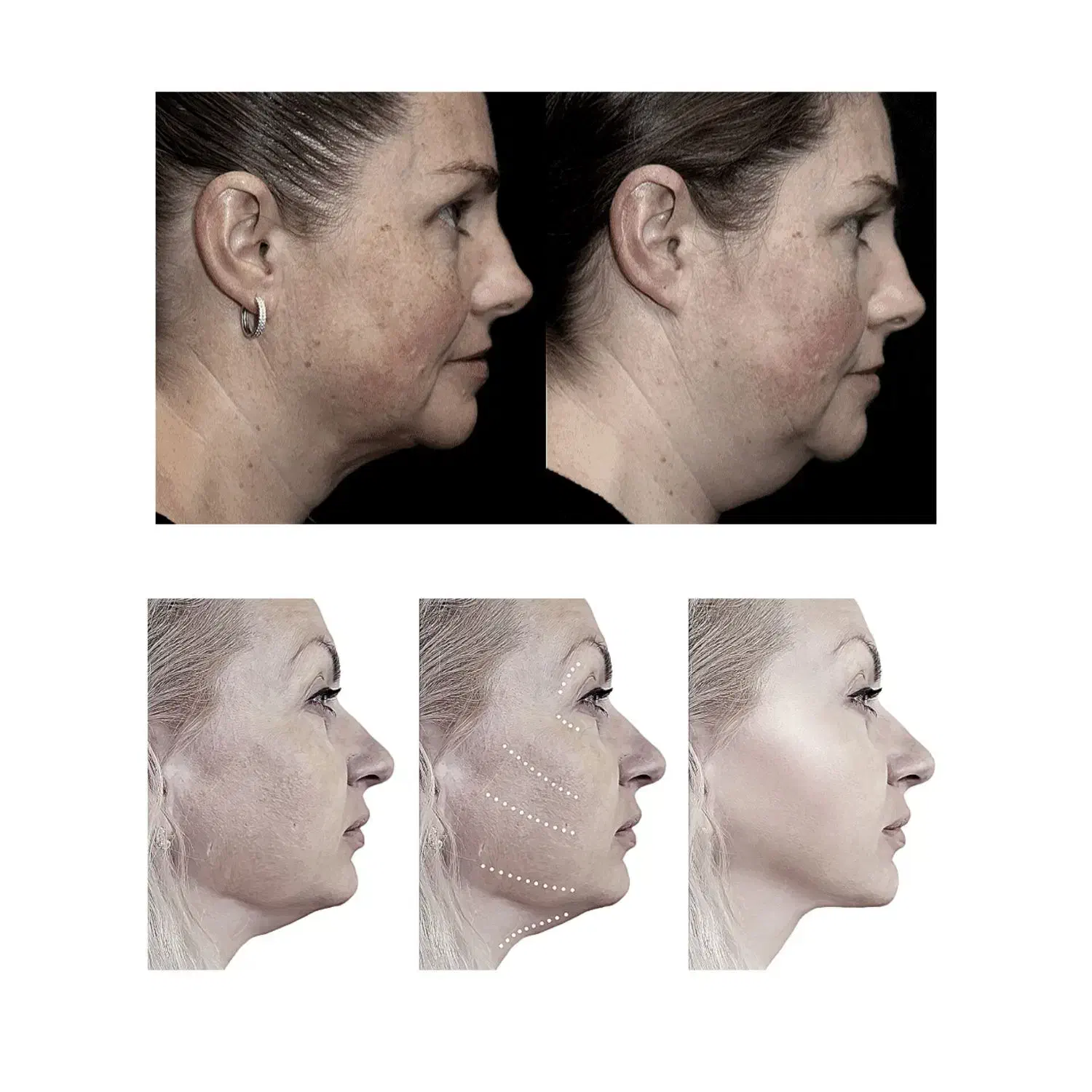 جراحی لیفت صورت پیشانی شقیقه خط خنده غبغب گردن|خدمات آرایشگری و زیبایی|تهران, ظفر|دیوار