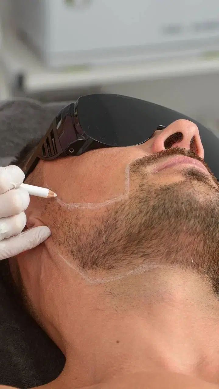قویترین لیزر الکس شاتی رشت توتال ۹۹۰ با رفع تیرگی|خدمات زیبایی و سلامت|رشت, گلسار|دیوار