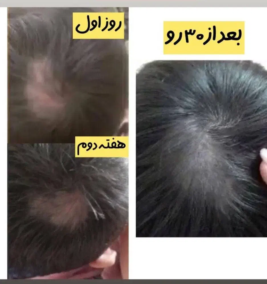 اکسیرپرپشتی مو ،مژه و ابرو|خدمات آرایشگری و زیبایی|گلبهار, شهر جدید گلبهار|دیوار