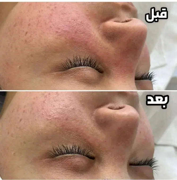 فشیال تخصصی ودرمانی|خدمات آرایشگری و زیبایی|رفسنجان, |دیوار