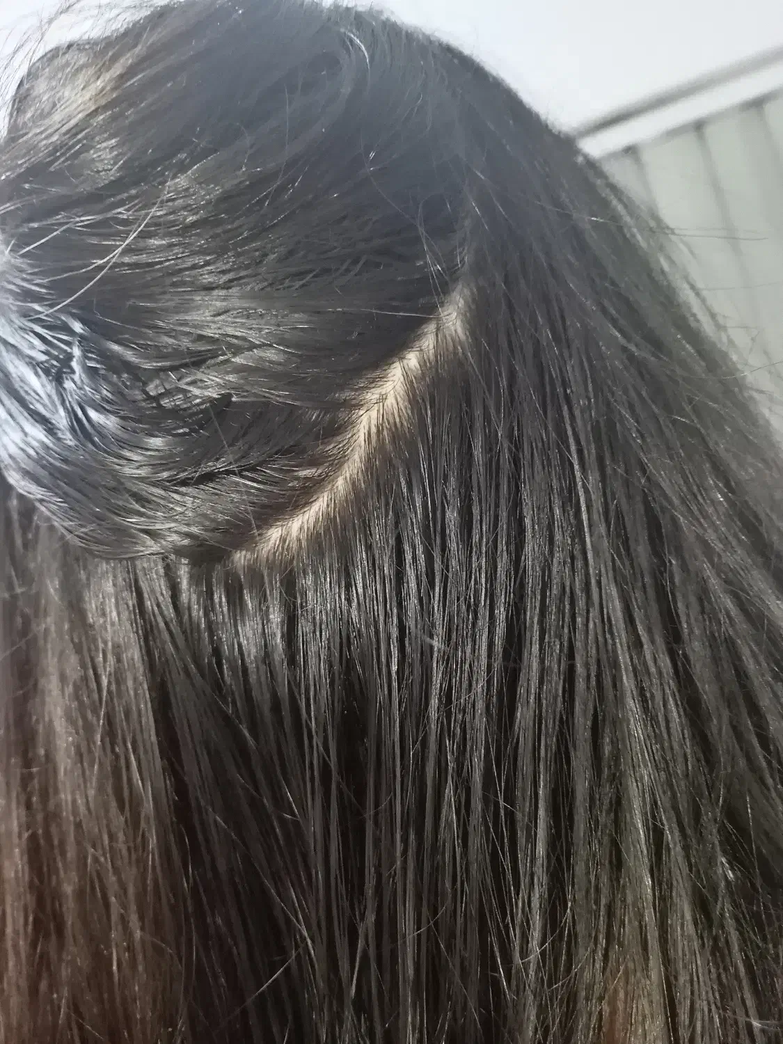 پاکسازی شپش ورشک|خدمات آرایشگری و زیبایی|سبزوار, شرق کال میانی|دیوار