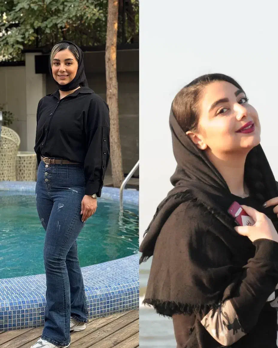 لاغری با بوتاکس معده|خدمات آرایشگری و زیبایی|تهران, جردن|دیوار