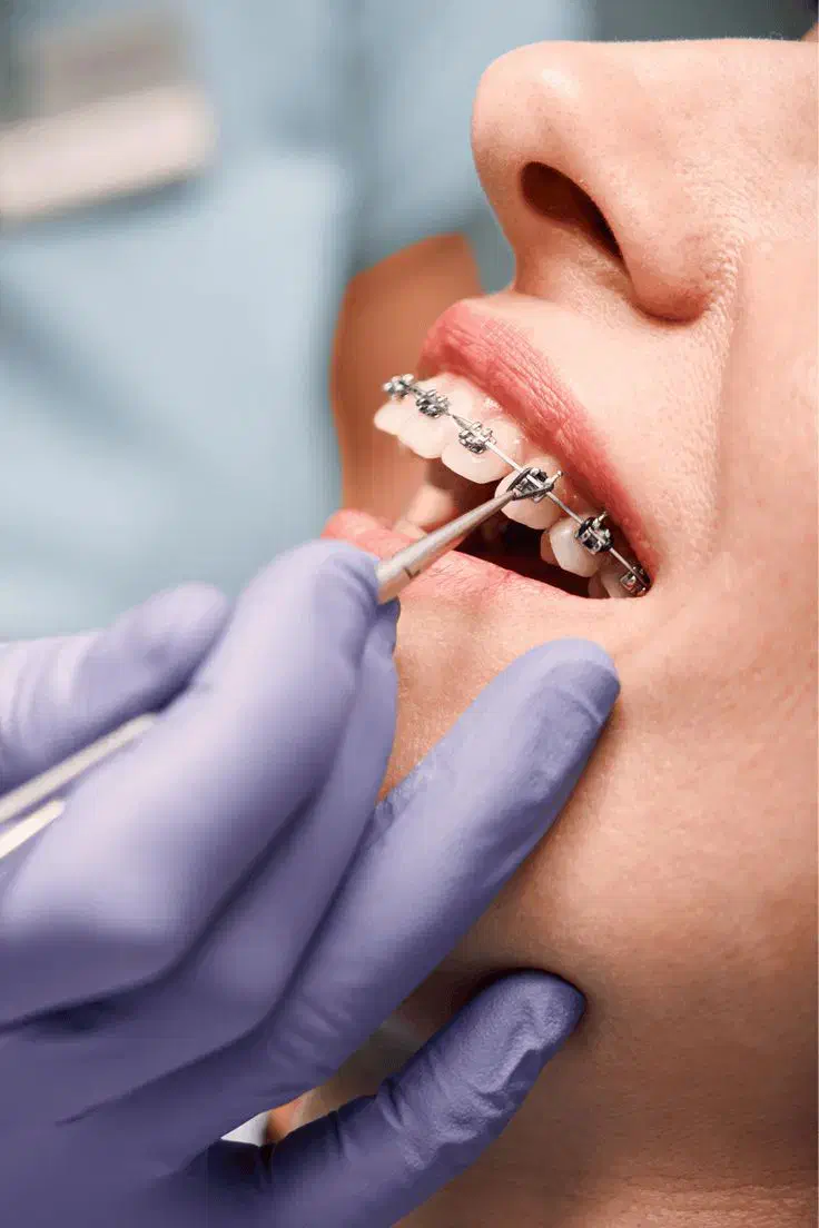 ارتودنسی اقساطی بدون چک معاینه رایگان|خدمات آرایشگری و زیبایی|اندیشه, شهرک صدف|دیوار