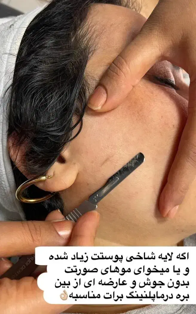 فیشیال و پاکسازی پوست|خدمات آرایشگری و زیبایی|پرند, فاز ۲|دیوار