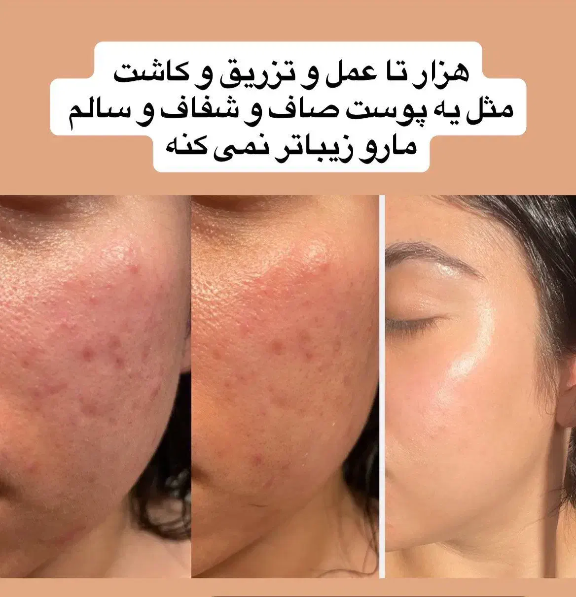 کرم سفید کننده|آرایشی، بهداشتی، درمانی|زابل, |دیوار