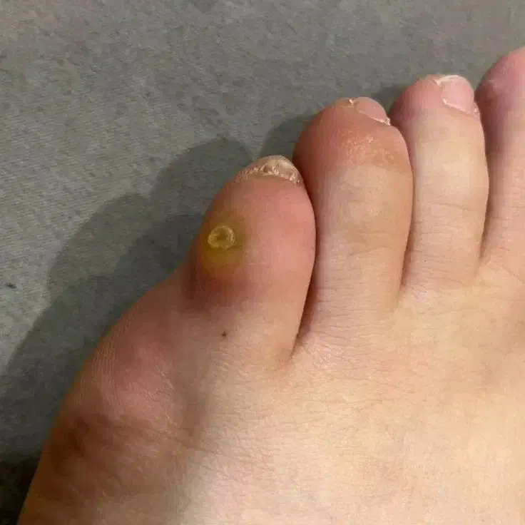 کفسابی پا.درمان ناخن پا.میخچه. ارتونیل ناخن پا|خدمات آرایشگری و زیبایی|کرج, کوی امامیه|دیوار