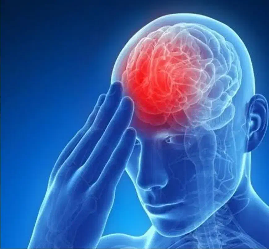 درمان ۱۰۰درصدی میگرن|آرایشی، بهداشتی، درمانی|مهاباد (آذربایجان غربی), |دیوار