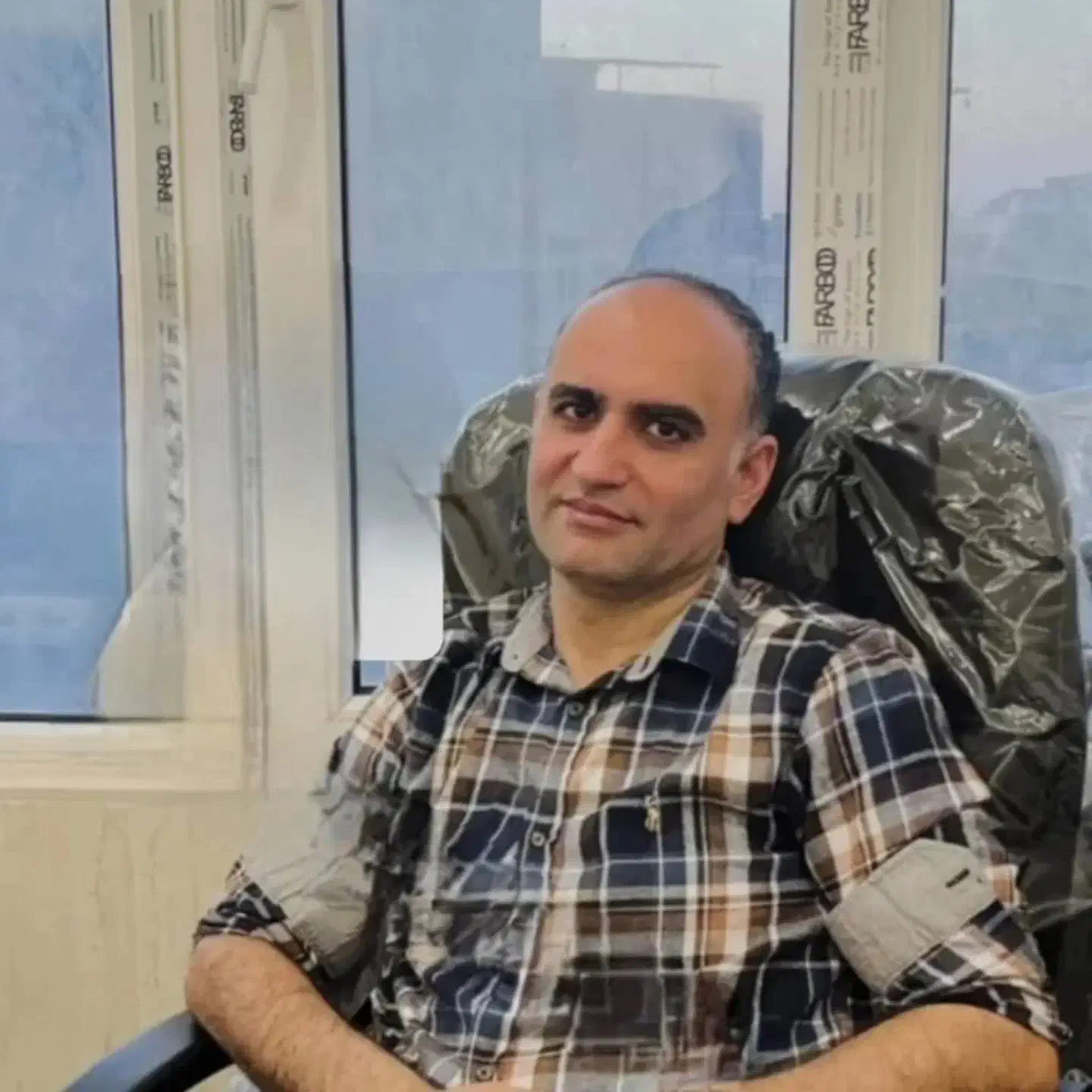 عمل بینی فقط با23ملیون|خدمات آرایشگری و زیبایی|قائمشهر, |دیوار