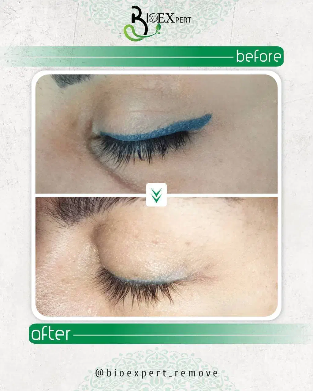 پاک کردن تاتوومیکروبلیدینگ بدون لیزر+آموزش بامدرک|خدمات آموزشی|تهران, جی|دیوار