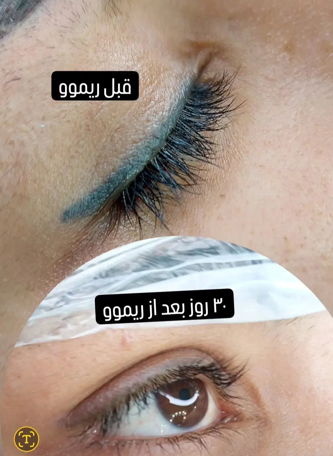 ریموو و پاک کردن تضمینی تتوی ابرو و چشم شما|خدمات آرایشگری و زیبایی|ایلام, |دیوار