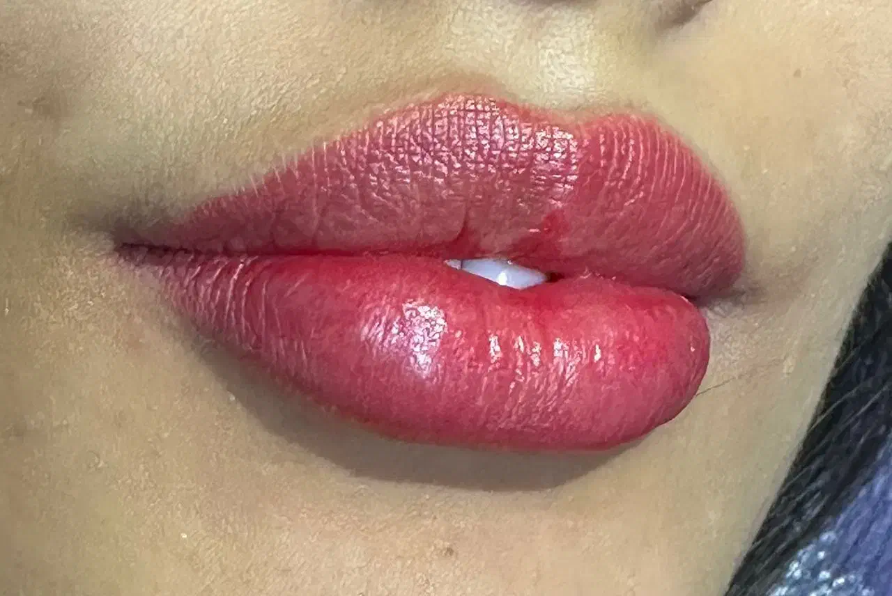 کلینیک پوست ومومایا|خدمات آرایشگری و زیبایی|کرج, شهرک اوج|دیوار