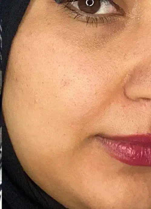 درمان ریزش مو و لک پوستی با محصولات اصل تراست|آرایشی، بهداشتی، درمانی|قدس, شهر‌قدس|دیوار