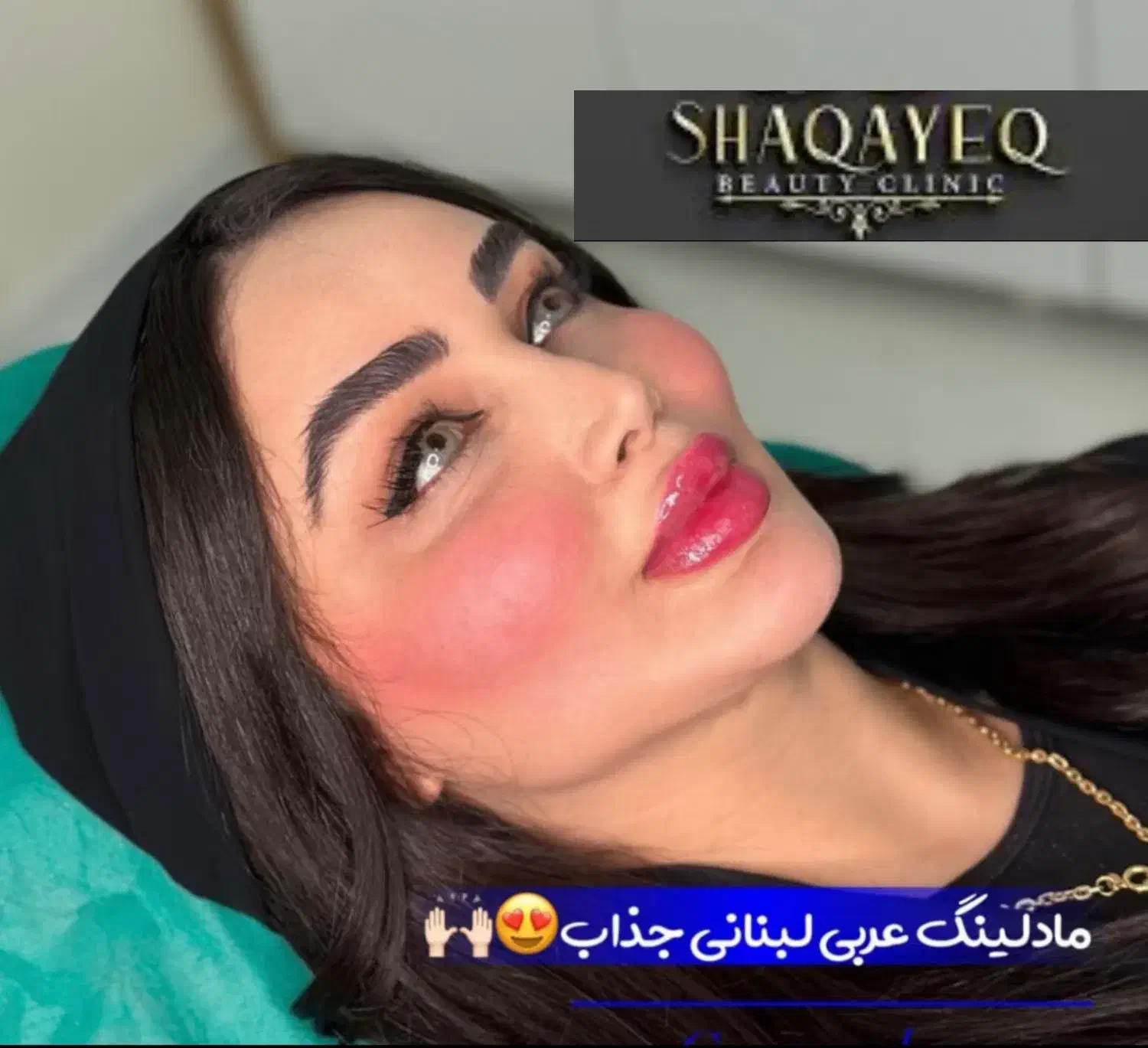 تزریق تخصصی ژل ومادلینگ وبوتاکس وهایفو درکلینیک|خدمات آرایشگری و زیبایی|کرمانشاه, |دیوار