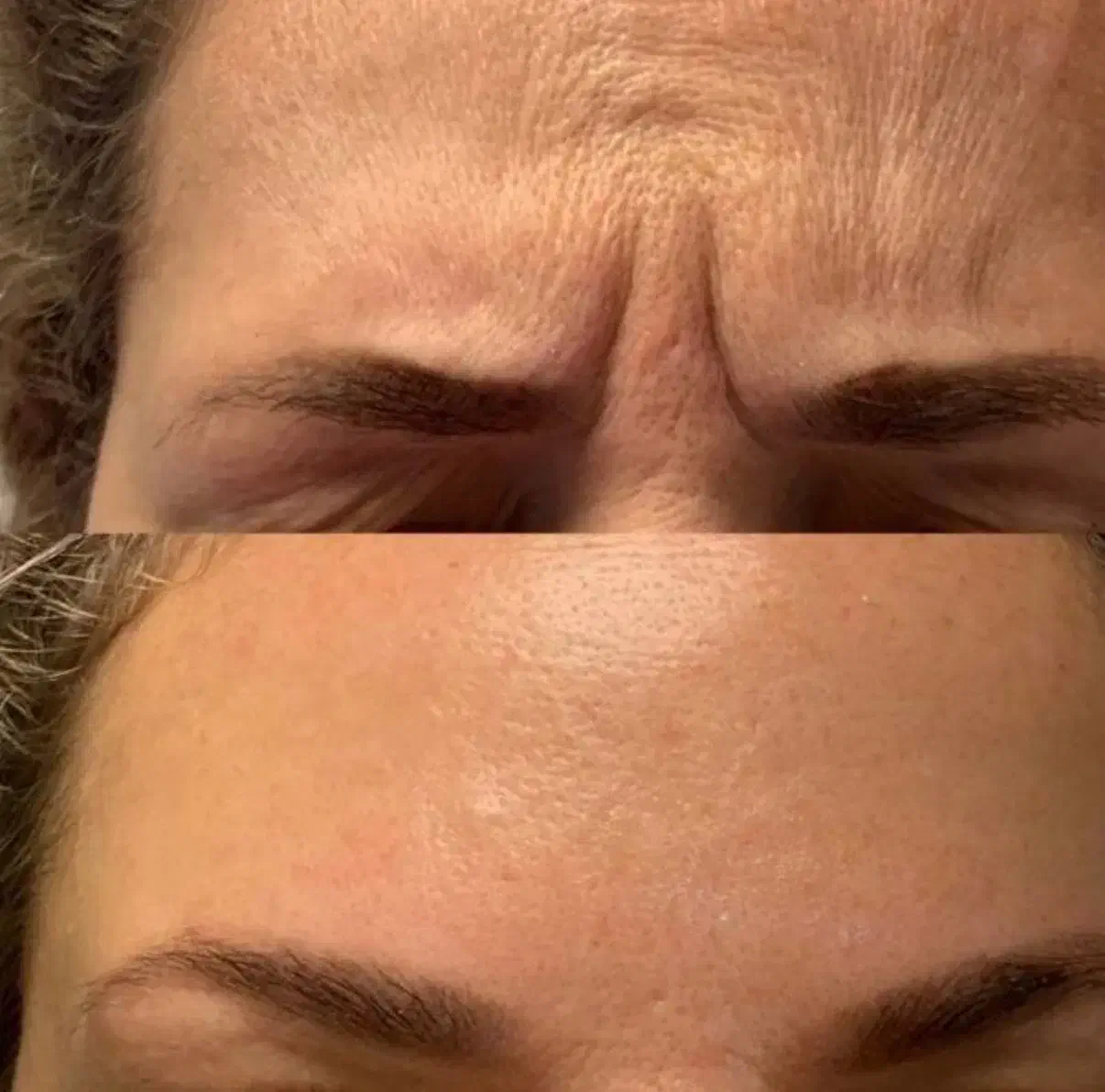 ژل لب/فیلر بادی/ مزوژل/بوتاکس /در کلینیک زیبایی|خدمات آرایشگری و زیبایی|تهران, الهیه|دیوار