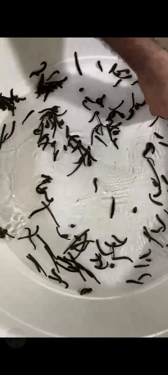 زالو طبی|آرایشی، بهداشتی، درمانی|قائم‌شهر, |دیوار