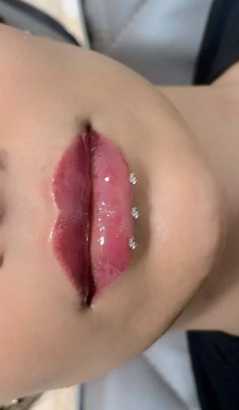 تخفیف ویژه ژل و بوتاکس|خدمات آرایشگری و زیبایی|گنبد کاووس, |دیوار